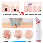 Load image into Gallery viewer, Blackhead remover, Electric acne cleaner

