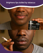 Load image into Gallery viewer, Yoxier™ | Brightening serum for dark or tobacco-damaged lips (Satisfaction guaranteed or your money back)
